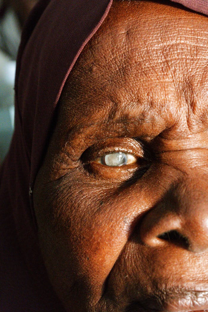Detailed close-up of an elderly woman's eye affected by cataract, showcasing texture and emotion.